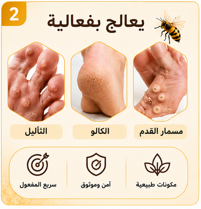 كريم ديفينفيرا تركيبة طبيعية بسم النحل لإزالة الثآليل ومسامير القدم والكالو