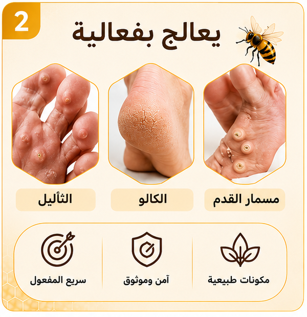 كريم ديفينفيرا تركيبة طبيعية بسم النحل لإزالة الثآليل ومسامير القدم والكالو